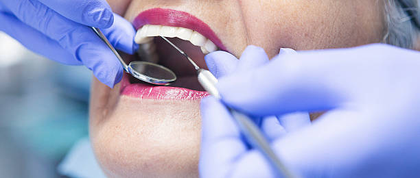 Best Emergency Tooth Extraction in Woodward, OK